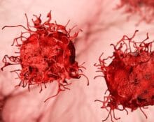 Image for top cancers in Singapore