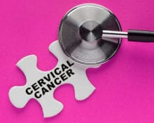 Options to treat cervical cancer in Singapore