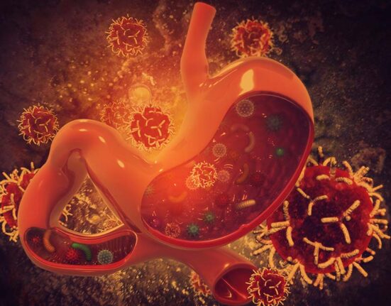 Stomach cancer in Singapore