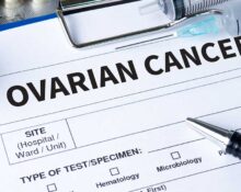 Ovarian Cancer Risk Factors