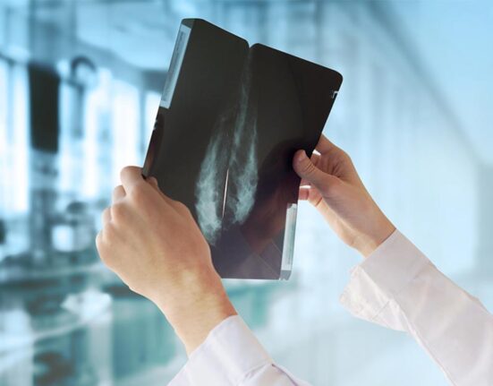 Mammogram Screening In Malaysia 马来西亚乳癌筛查