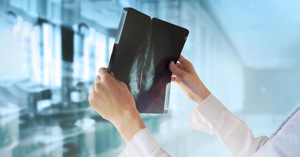 Mammogram Screening In Malaysia 马来西亚乳癌筛查