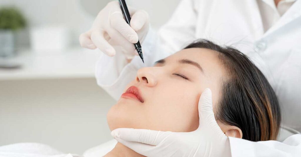 Rhinoplasty