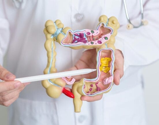 Colorectal Surgery Singapore