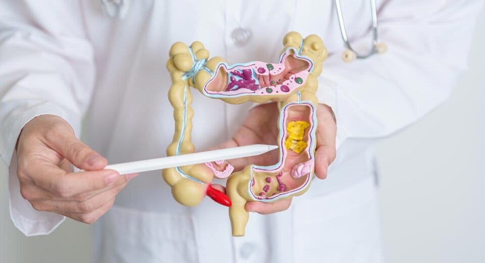 Colorectal Surgery Singapore