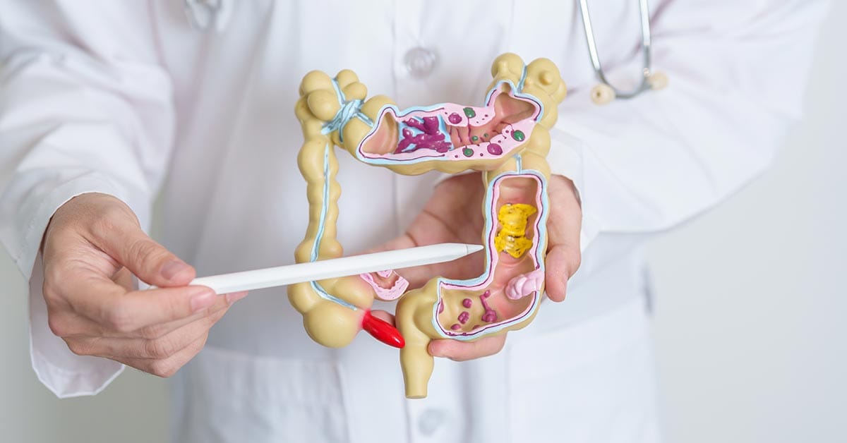 Colorectal Surgery Singapore