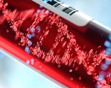 Blood Test For Ovarian Cancer