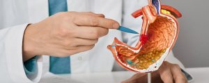 Stomach Cancer Singapore