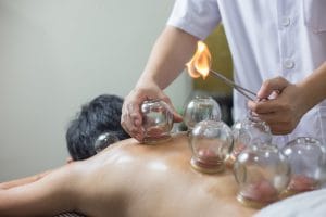 中医拔罐