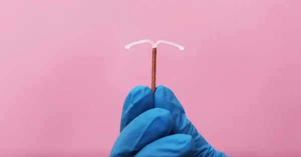 image of Contraceptive and IUD