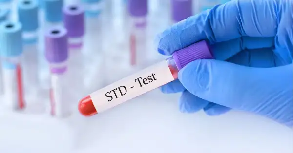 std-test-singapore