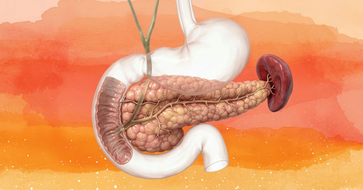 Pancreatic-Cysts