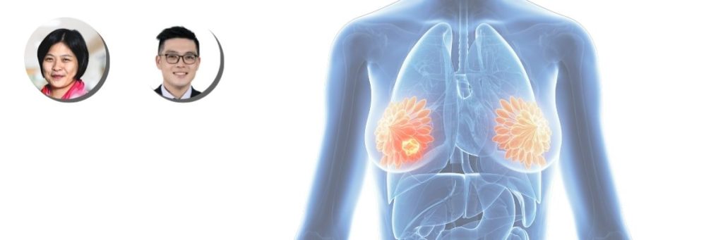 Breast-Cancer-Key-Visual