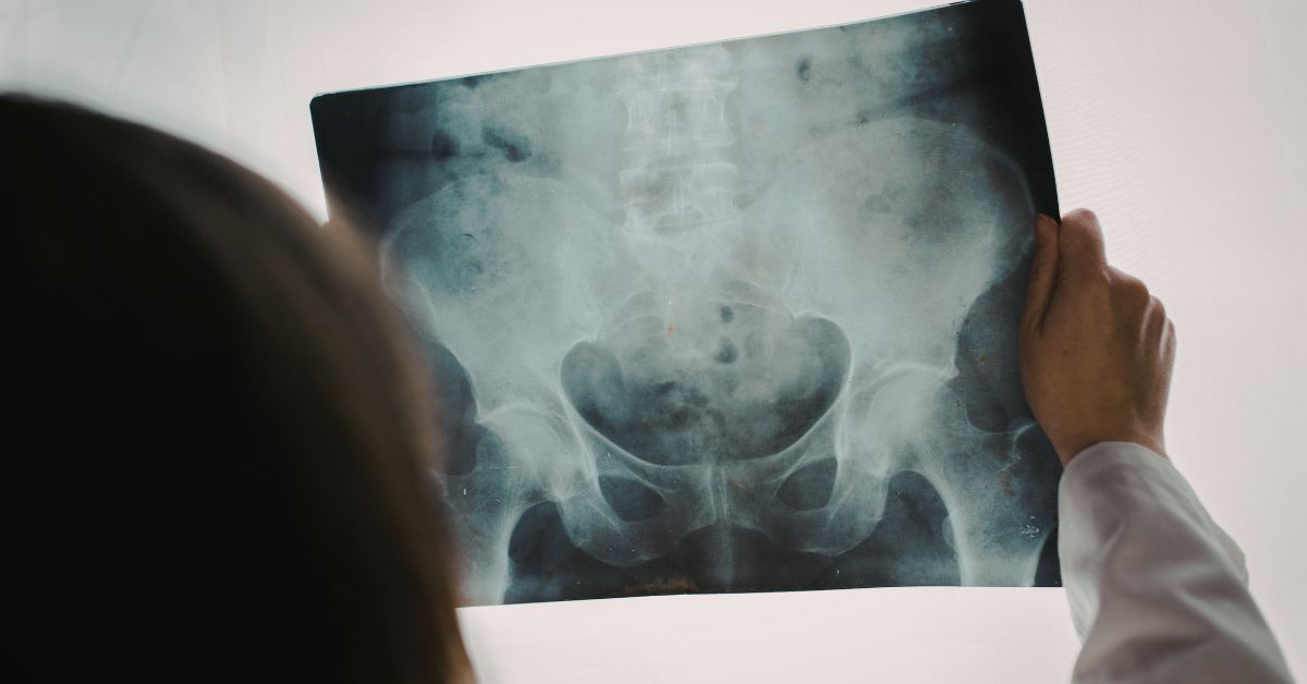 Chronic-Pelvic-Pain-Management-Specialist