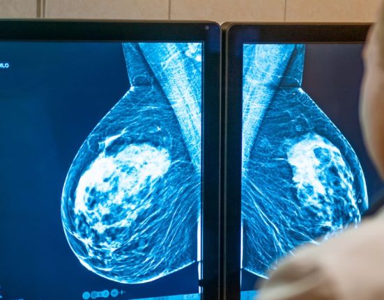 Suspicious-Mammogram-Result