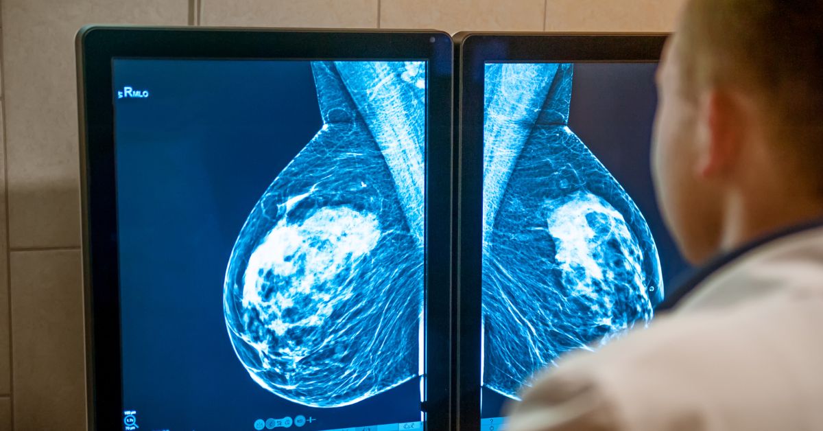 Suspicious-Mammogram-Result