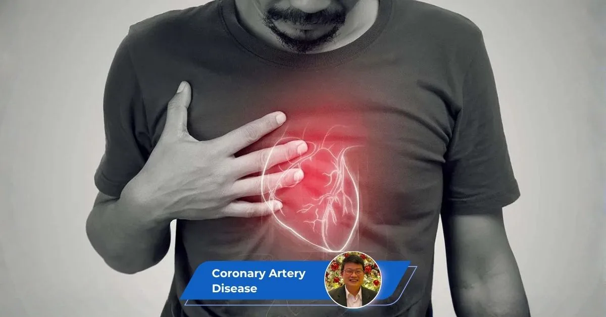 Coronary Artery Disease Treatment Malaysia