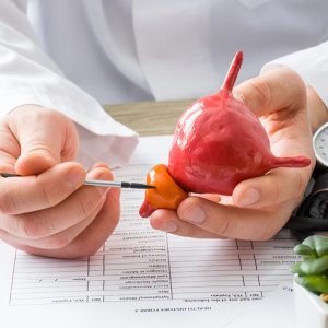 马来西亚男士前列腺健康